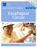 Esophageal Cancer - Dayton Physicians Network