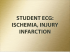 student ecg: ischemia, injury infarction