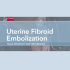 Uterine Fibroid Embolization